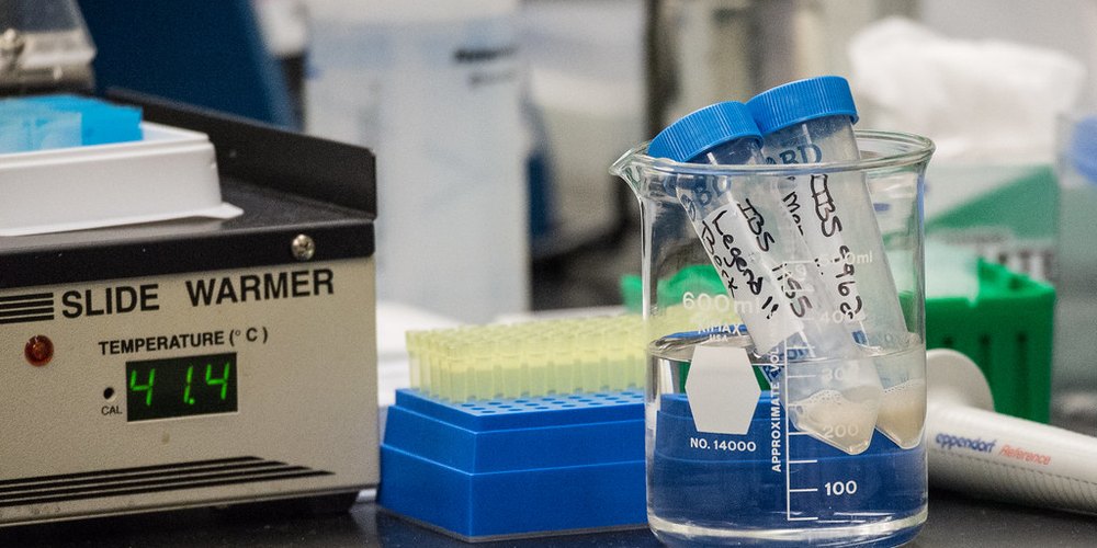 Outbreak Of A New Deadly Virus